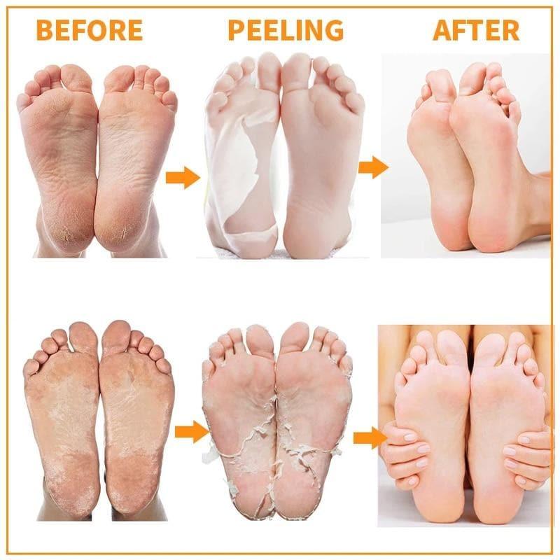 1 Pair Feet Mask Peel Moisturizing Mask, Vitamin C - Ammpoure Wellbeing