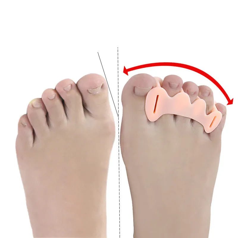 1Pair Hard Silicone Toe Finger Separator 3 Hole Hallux Valgus Orthopedic Spacers Bunion Overlapping Hammer Foot Corrector - Ammpoure Wellbeing