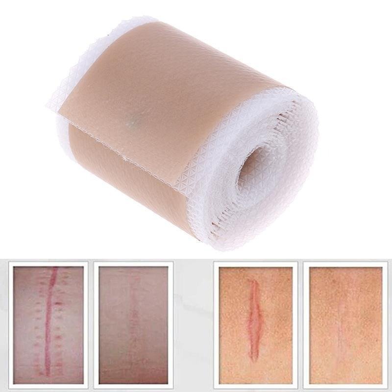 Efficient Surgery Scar Removal Silicone Gel Sheet Therapy Patch for Acne Trauma Burn Scar Skin Repair Scar Treatment - Ammpoure Wellbeing