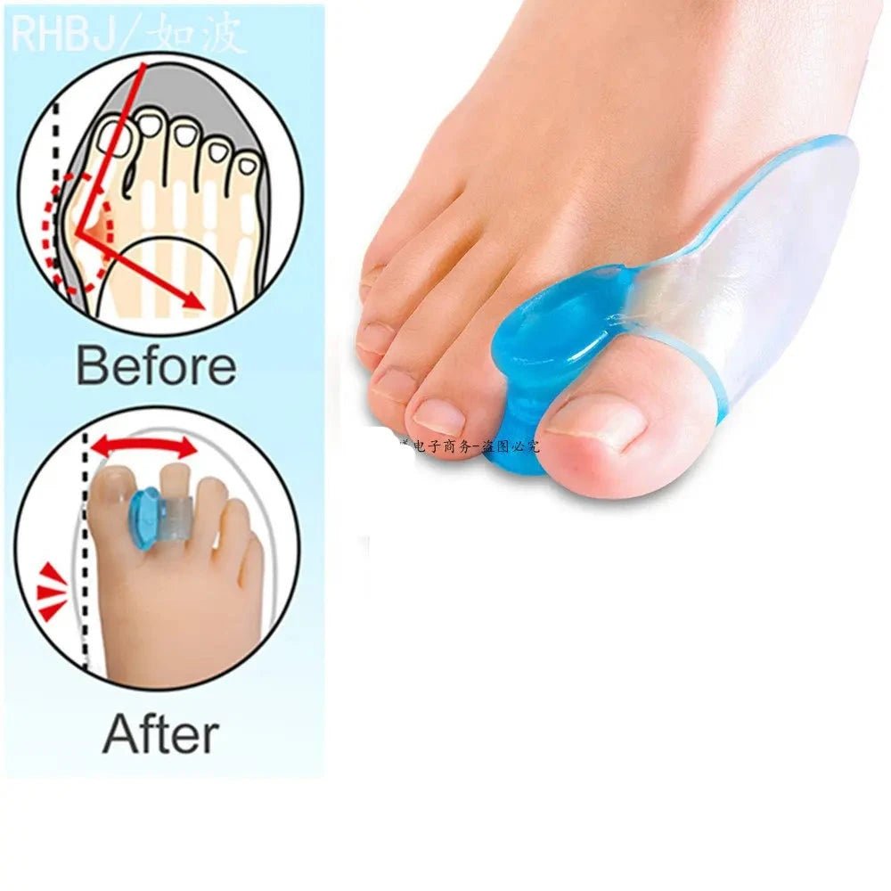 Silicone Gel 2pcs Thumb Corrector Bunion Little Toe Protector Separator Hallux Valgus Finger Straightener Foot Care Relief Pads - Ammpoure Wellbeing