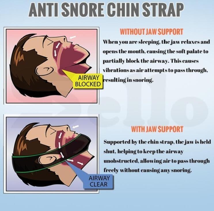 Wholesale Neoprene Anti Snore, Stop Snoring Chin Strap - Pack of 10 - Ammpoure Wellbeing